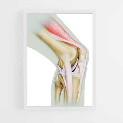 ap-knee-1 cadre Blanc