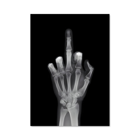 Poster Fracture de l'Attitude