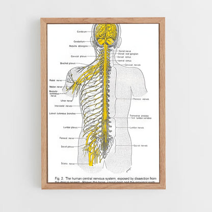 ap-nerve-2 cadre Bois clair