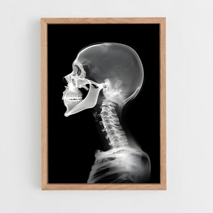 ap-x-rays-1 cadre Bois clair